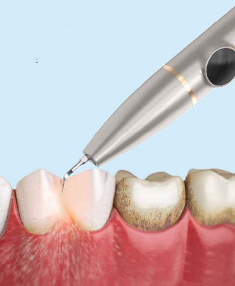 Skaler Dentystyczny z Kamerą i Latarką Ultradźwiękowy Braders