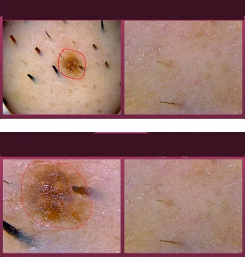 Detektor Skóry Głowy i Włosów 5-200X Analizator Trychologiczny Wypadanie