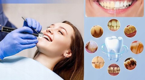 Profesjonalny Skaler Stomatologiczny do Zębów Ultradzwiękowy 4 Tryby Brader